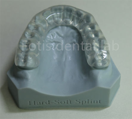 Verstelbare en aanpasbare orthodontische retainer expander voor tandbehoud en -uitbreiding