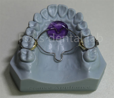 Tandheelkundig laboratorium betaalbare orthodontische expander retainer effectief bij het vasthouden en uitbreiden van tanden