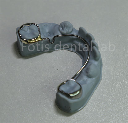 China Tandheelkundig Laboratorium Orthodontic Retainer Voor Tanden Uitbreiding