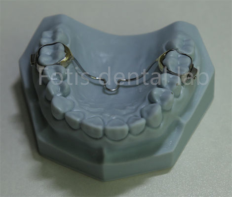Versatile tandheelkundige expanderhouder betaalbare oplossing voor de meeste orthodontische behandelingen
