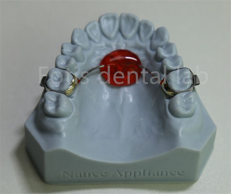 Tandheelkundig laboratorium Orthodontic Palatal Expander betaalbaar en compatibel met de meeste behandelingen