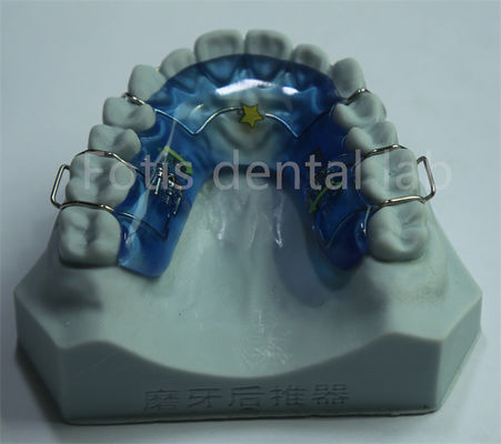Eenvoudig schoon te maken en te onderhouden veelzijdige orthodontische verruiming voor duurzame tanden