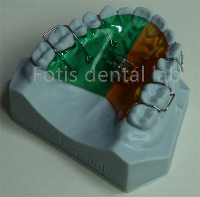 Veelzijdige en comfortabele orthodontische retainer expander voor effectieve tandbehoud