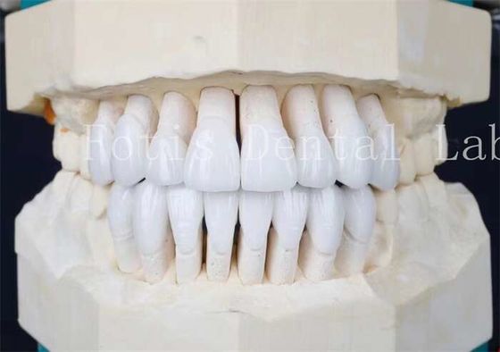 Kleefcement en hoge sterkte synthetische laminaatfoelie Het perfecte paar
