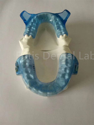 Geavanceerde orthodontische apparatuur voor superieure tandbalansresultaten